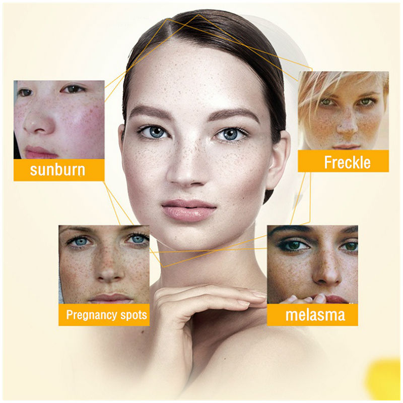 Dimollaure Whitening Freckle C - Skincare Herbal avaliação e preço