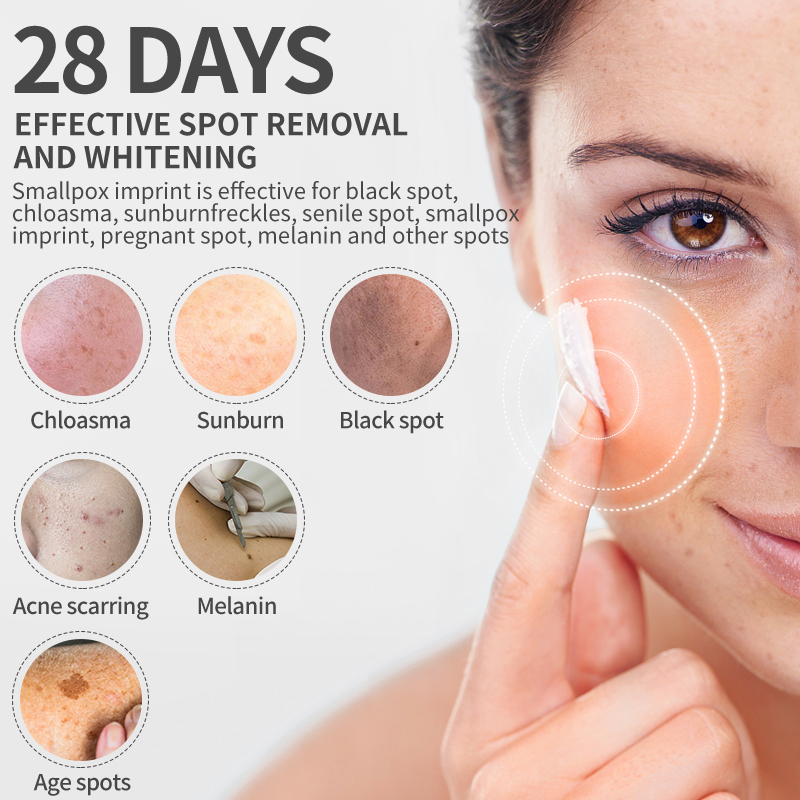 Dimollaure Whitening Freckle C - Skincare Herbal avaliação e preço